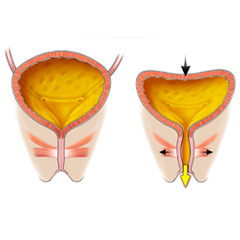 Vessie: Module d'anatomie et de physiologie