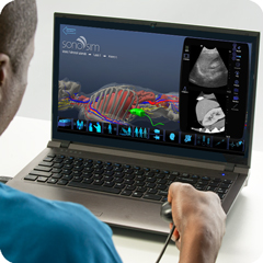 Ghiandole surrenali: modulo anatomia e fisiologia - screenshot Simulatore di ultrasuoni per ghiandole surrenali: modulo anatomia e fisiologia