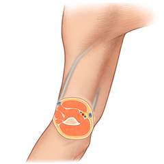 Tissu mou: module d'anatomie et de physiologie