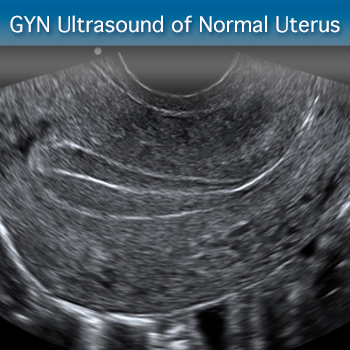 GYN Ultrasound of Nonpregnant Normal Uterus: Advanced ...