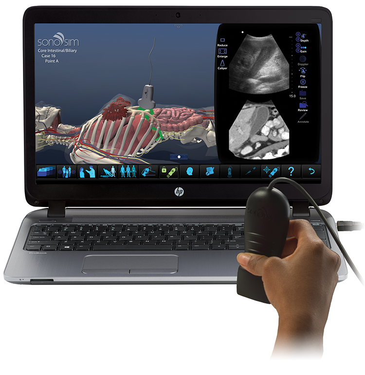 The SonoSim® Ultrasound Training Solution