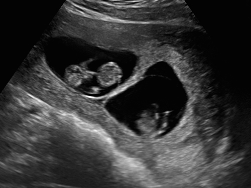 Simulationszentrum Sonosim