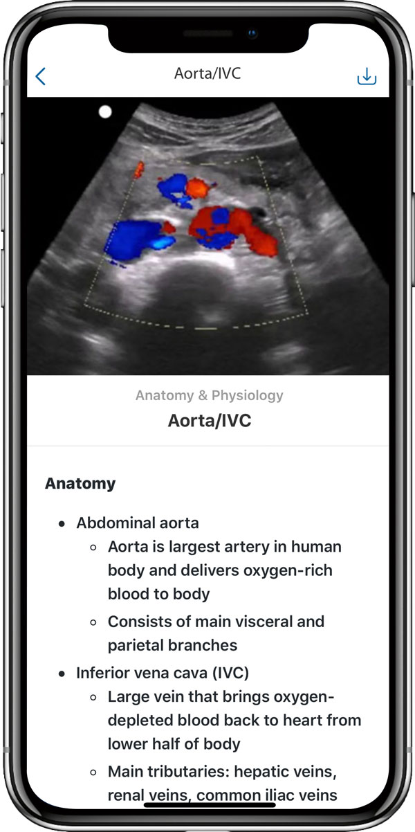 Ultrasound training on the cloud allows for sonography training at school or home, with multiple content choices