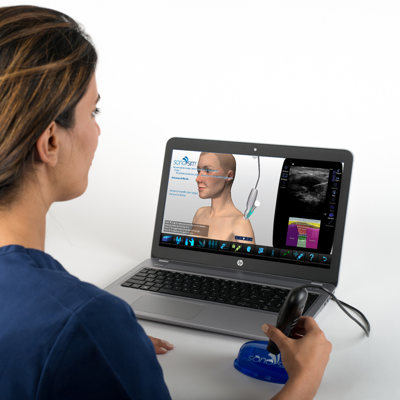 Iniezione e aspirazione dell'articolazione acromioclavicolare: modulo di procedura - screenshot Simulatore di ultrasuoni per iniezione e aspirazione dell'articolazione acromioclavicolare: modulo di procedura